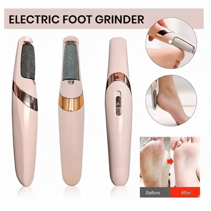 Electric Callus Remover