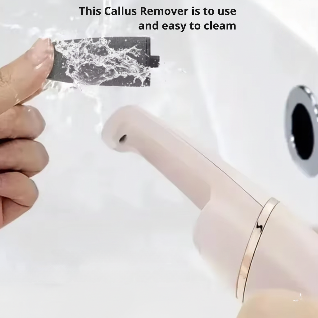 Electric Callus Remover