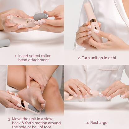 Electric Callus Remover
