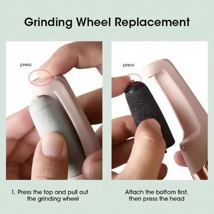 Electric Callus Remover